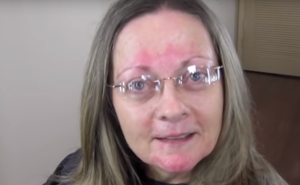 A szemüveges, rosaceás arcú 60 éves hölgy ragaszkodott hozzá, hogy csak úgy alakítsák át, hogy természetes maradjon: 25 évet „faragtak le róla”