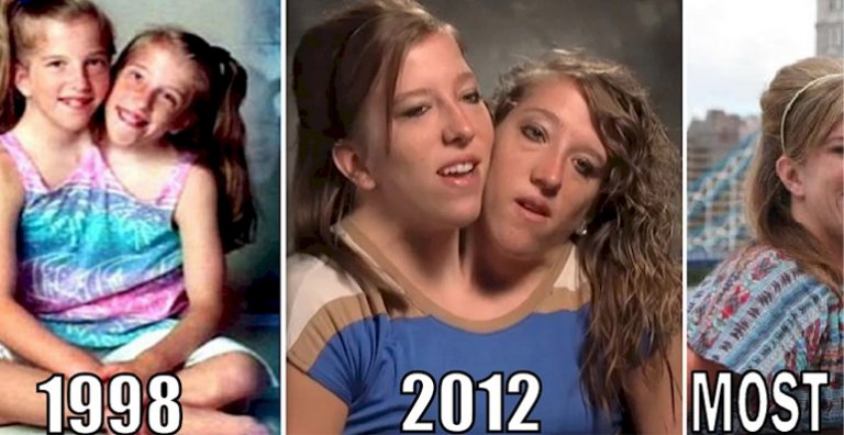 Idén betöltötték a 34. életévüket a sziámi ikrek! Lényeges közleményt adtak ki