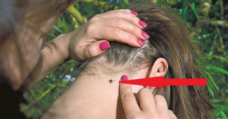 Nagymamám tanította ezt a kis technikát. Ezért nincs bennem soha egyetlen kullancs sem: