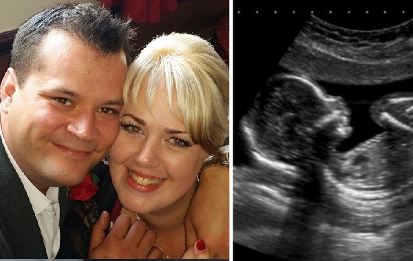 A várandós hölgy a 22. héten megérzi, hogy a babája többé már nem mozdul a méhben. Az orvos megtört hangon fordul a fiatal párhoz: