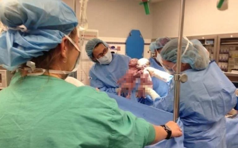 A nő szülés után meghallja, hogy az orvos hangosan felkiált a szülőszobában. Mikor közelebbről megnézi a kisbabáit, rögtön rájön, miért