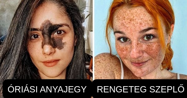 13 egyedi megjelenésű ember, akit gyerekkorában csúfoltak, most azonban mindenki különleges szépségüket ünnepli!