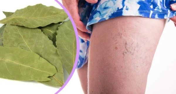 Ez az egyszerű levél megszabadíthat a memóriazavartól és a fejfájástól, ráadásul a visszereket is enyhítheti! Csak akkor hat, ha így készíted el!