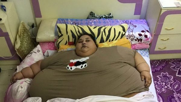 Elhagyhatta a kórházat: 325 kilót fogyott a világ legkövérebb nője – fotó