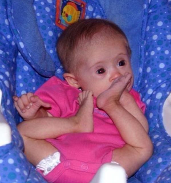 Az orvosok azt mondták a szülőknek, adják intézetbe a Down-szindrómás lányt – ám olyan csodás karriert fut be, ami szinte senkinek sem sikerül!  Ilyen gyönyörű most: