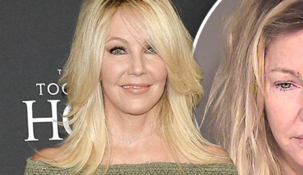 61 éves korára emberi ronccsá vált az egykor gyönyörű színésznő: arca teljesen felpüffedt, szeme csíkká szűkült