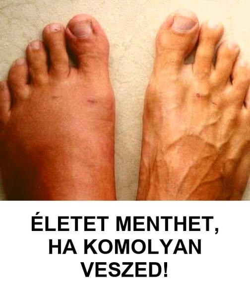 A szívroham előtt egy hónappal a tested figyelmeztet! Ez a 7 jel nagyon fontos, főleg a 6. jel!