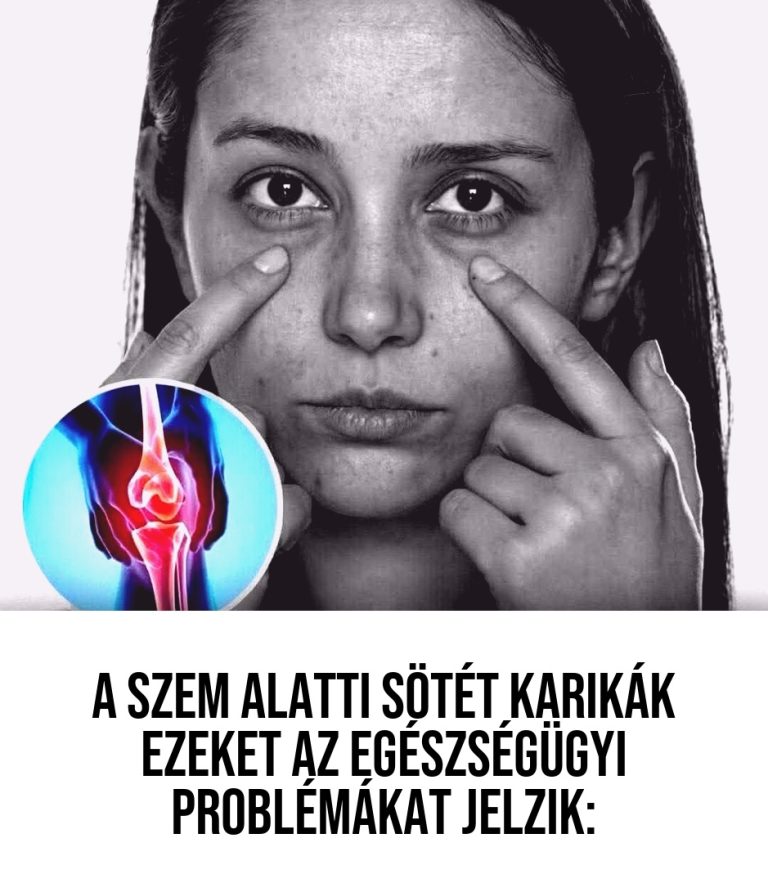 Fogalmam sem volt róla, hogy ezért van nekem is! 😳