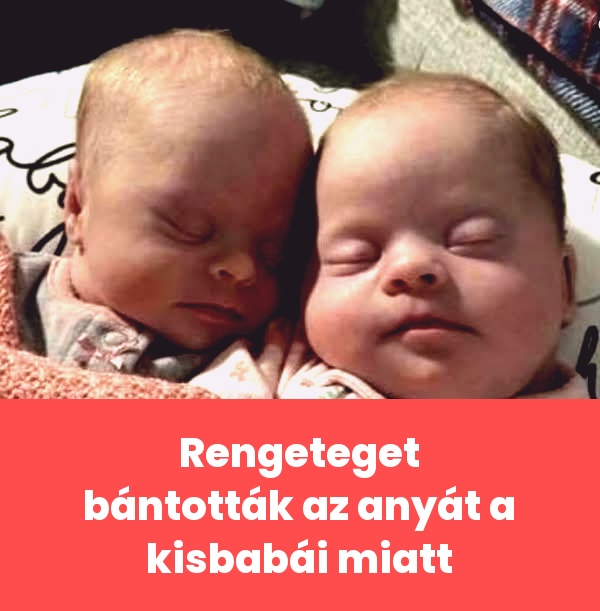 💔 Nem akarok ilyen babákat… Ha az én gyermekem így születik, tuti örökbe adom: mondta egy nő a friss édesanyának..