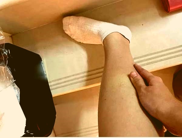 A lábad vércukormérő: óvakodj a cukorbetegségtől, ha ilyen tüneteket észlelsz magadon! 
Sokan nem ismerik fel a testük által küldött jeleket 😔