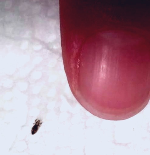 A férjem ezt találta a gyerekünk hajában. Rögtön arra gondoltunk, hogy kell-e aggódnunk, és nem tévedtünk! 😔 Részletek kommentben