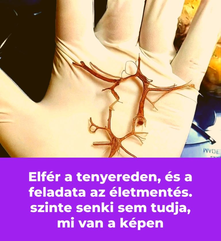 Elfér a tenyereden, és a feladata az életmentés. szinte senki sem tudja, mi van a képen