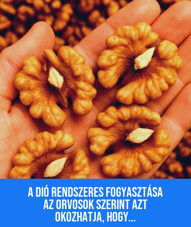 A dió rendszeres fogyasztása az orvosok szerint azt okozhatja, hogy…
