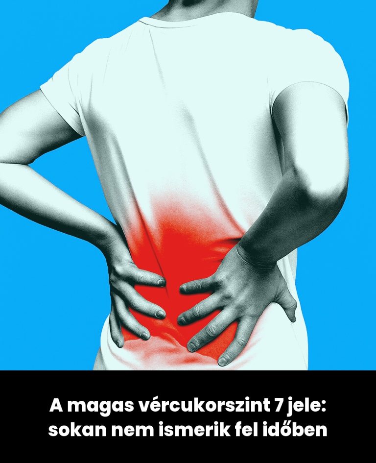 A magas vércukorszint 7 jele: sokan nem ismerik fel időben