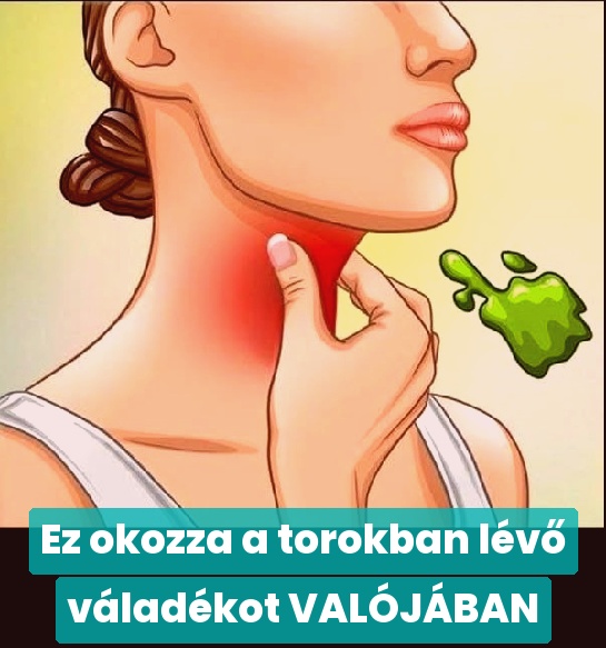 Ez okozza a torokban lévő váladékot VALÓJÁBAN