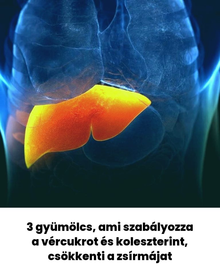 3 gyümölcs, ami szabályozza a vércukrot és koleszterint, csökkenti a zsírmájat