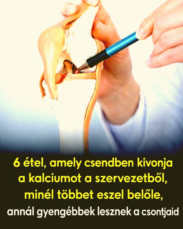Ez a 6 étel szép csendben kivonja a kalciumot a szervezetből, legyengíti a csontokat 👇