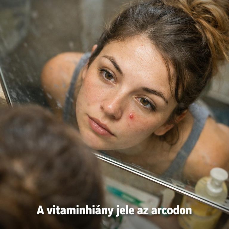A vitaminhiány 7 jele az arcon